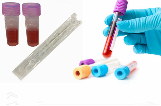 Gespritzte bukkale Putzlappen DNA für das Probieren Nylonfaser-des sterilen Transport-Putzlappens mit Rohr