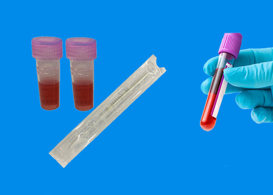 Gespritzter bukkaler Putzlappen Exemplar-Sammlungs-DNA mit Bewahrungs-Lösung DNA-Prüfungs-Ausrüstung